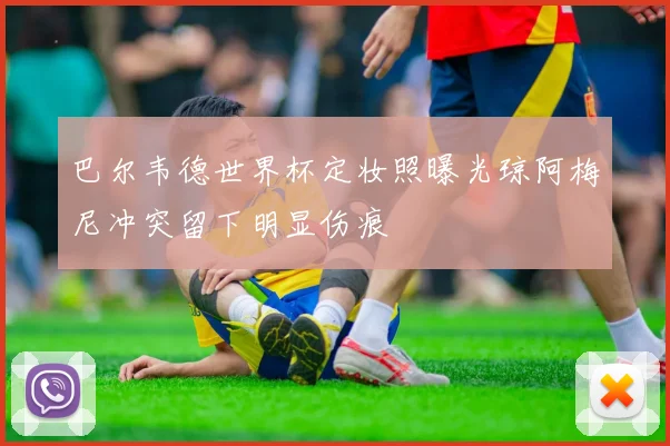 巴尔韦德世界杯定妆照曝光琼阿梅尼冲突留下明显伤痕